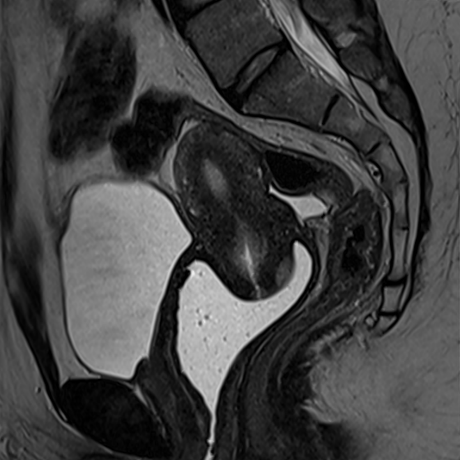 Anatomia Pélvica em Imagens - Ressonância Magnética