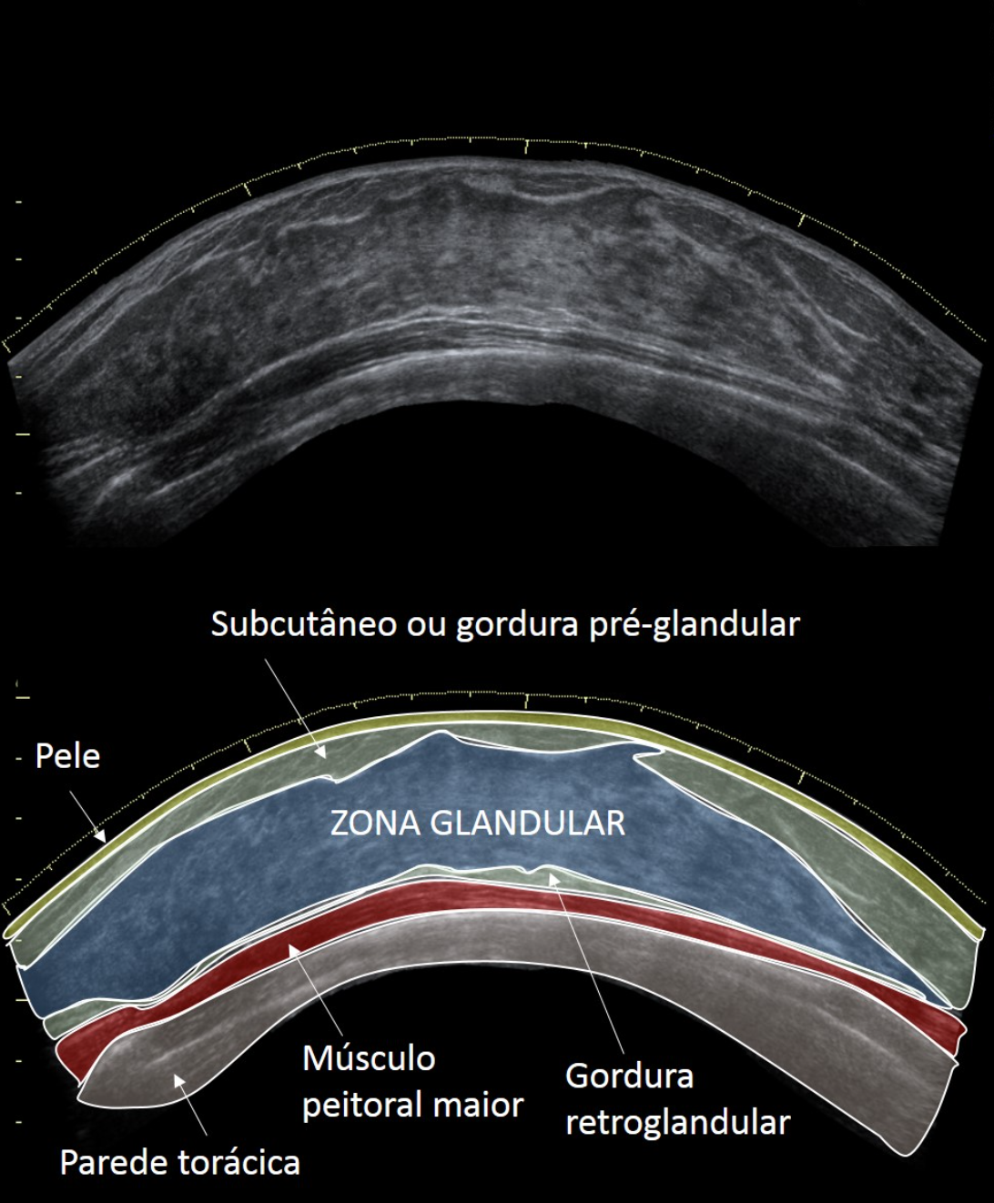 Anatomia ultrassonográfica da mama