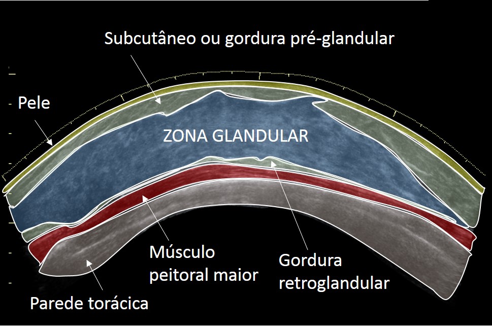 Anatomia ultrassonográfica da mama