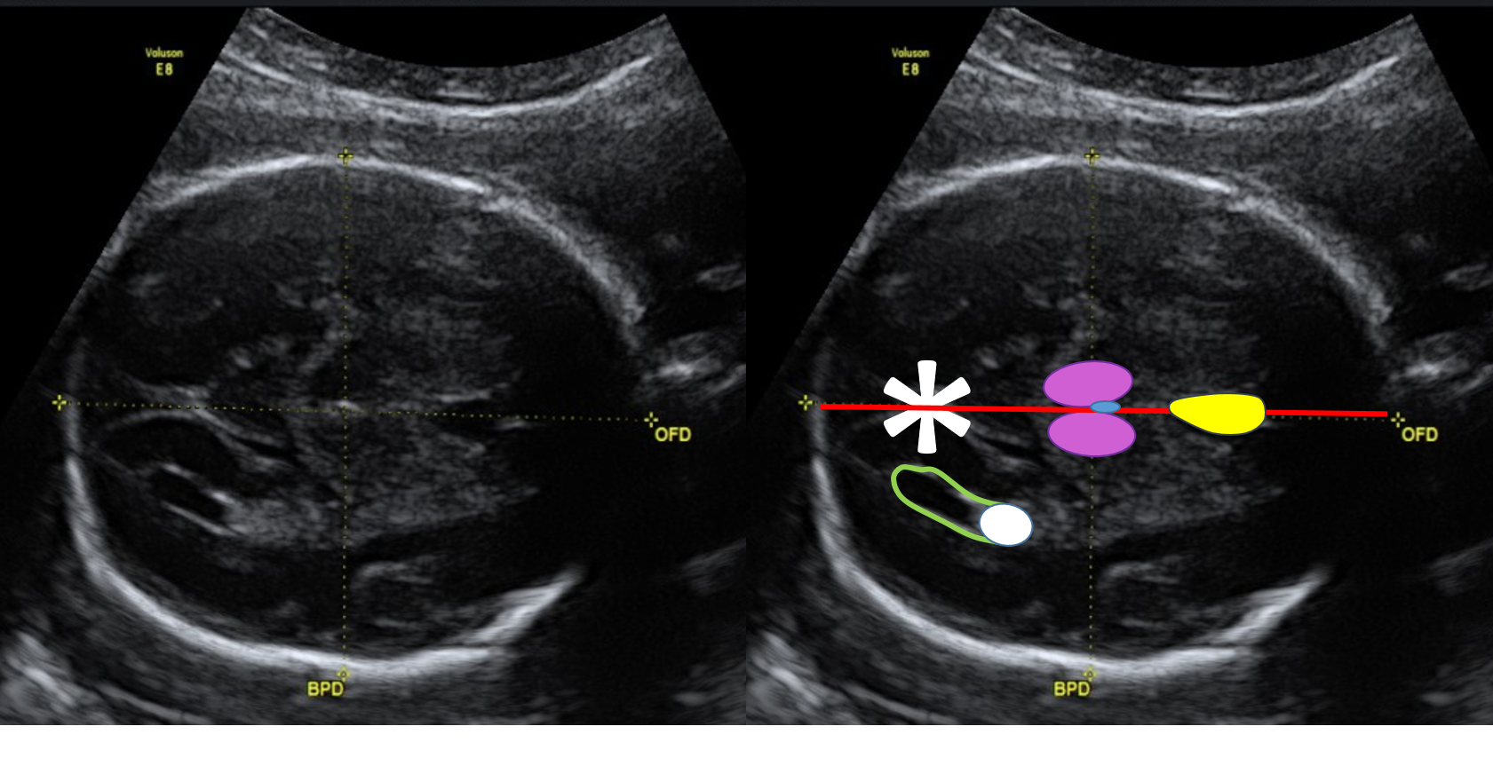 CIrcCefal_Aula_Biometria