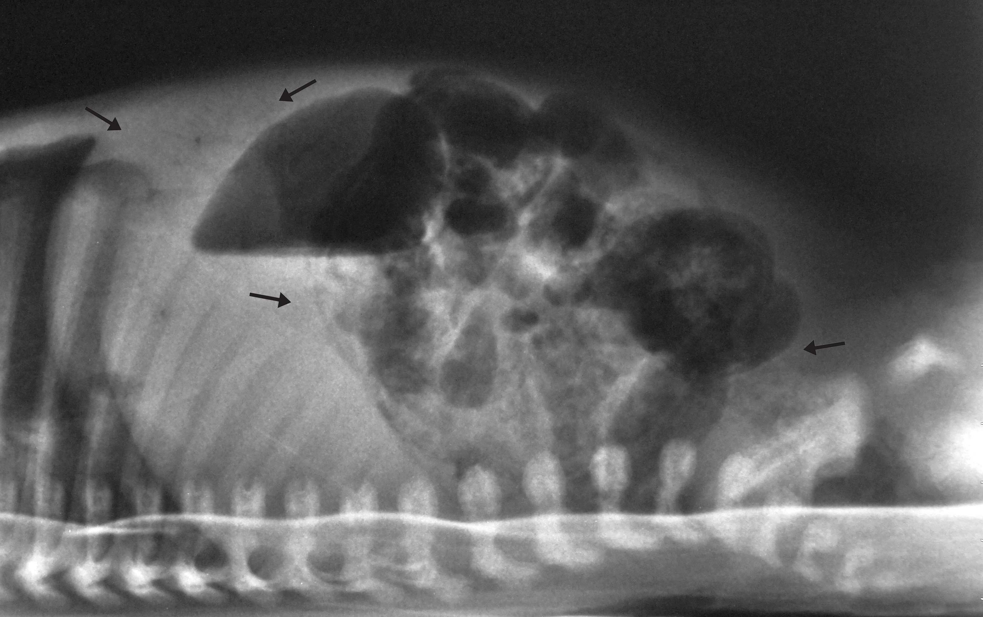 Enterocolite necrosante em recém-nascido: sinais radiológicos