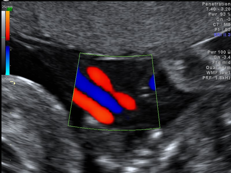 doppler-vitalidade-fetal-img-20