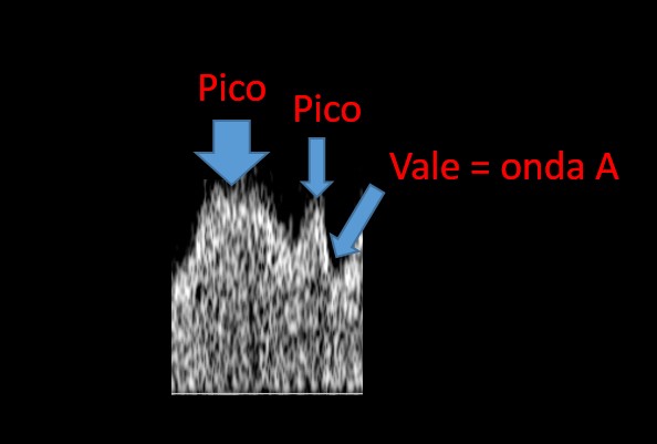 doppler-vitalidade-fetal-img-12