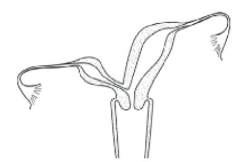 Modelo de laudo de ultrassonografia para avaliação de mal formação Mulleriana.