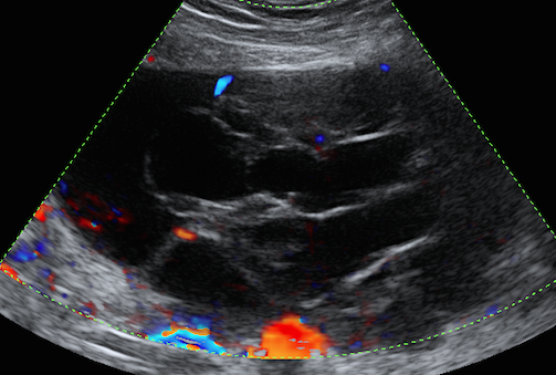 O que são e para que servem as regras simples (simple rules) do grupo iota?