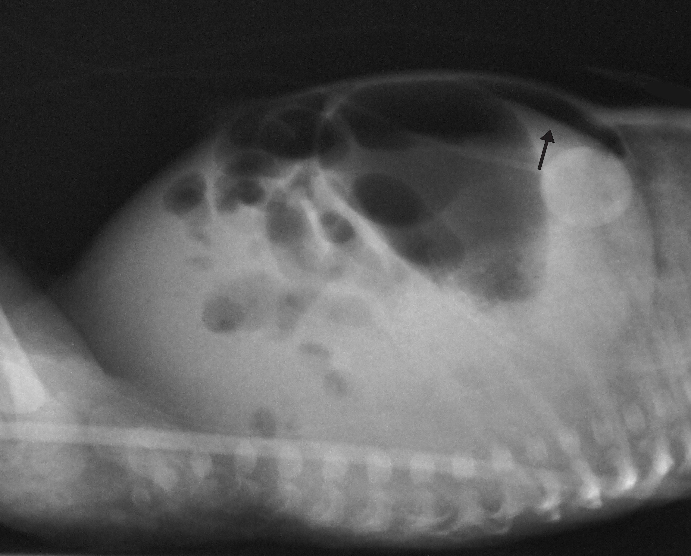 Perfuração intestinal espontânea em recém-nascido ocasionando pneumoperitôneo