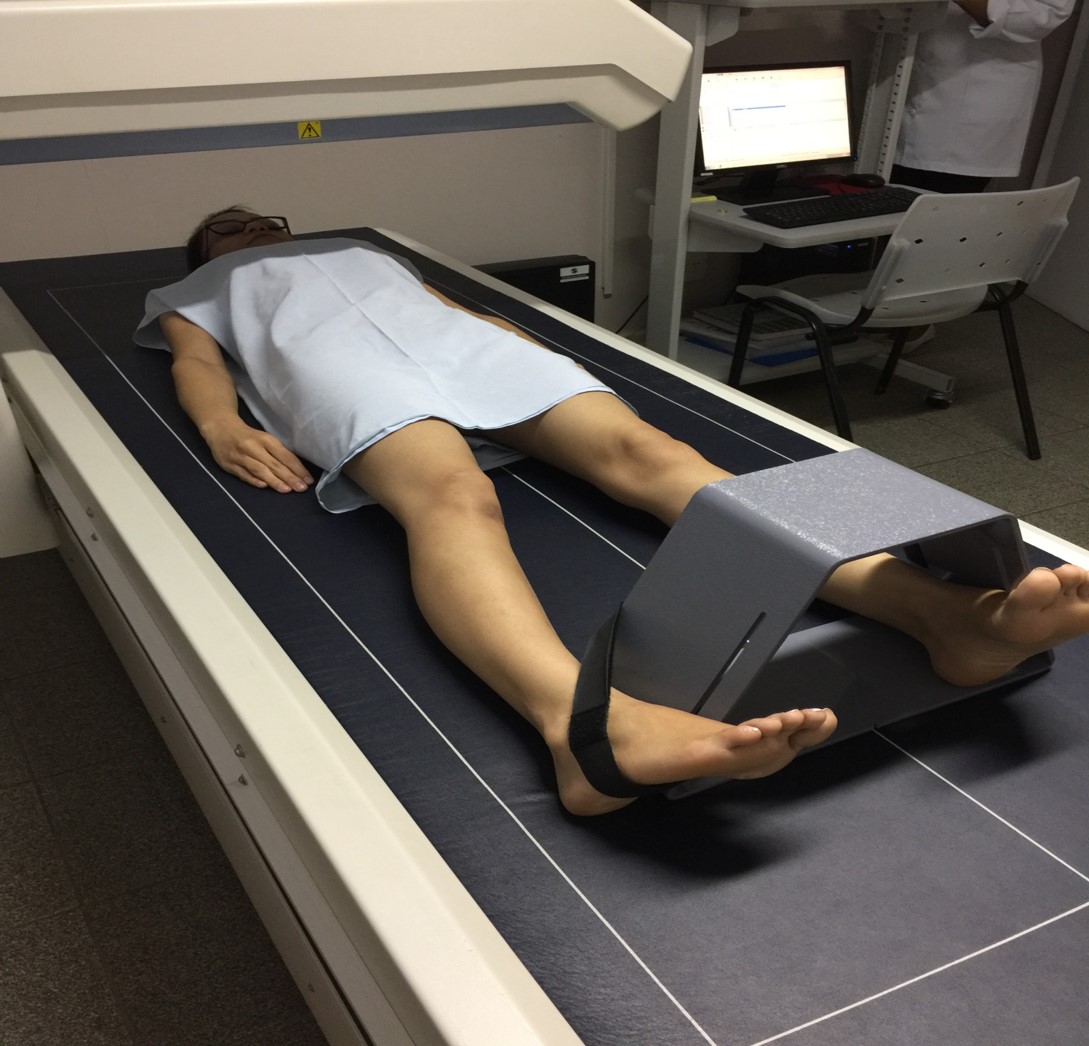 Recomendações para a  densitometria óssea na avaliação da densidade mineral óssea na saúde da mulher no climatério