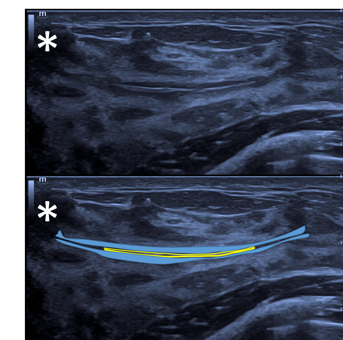 ducto_Sonoanato_USmama