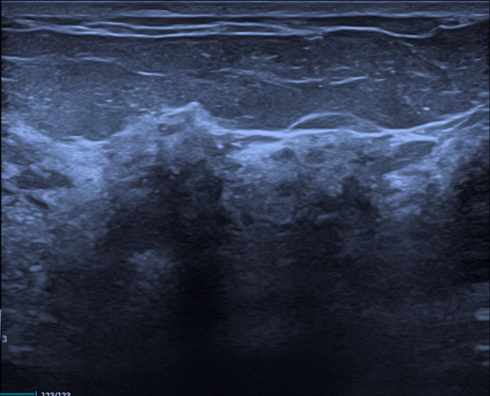 Parenquimaheterogeneo